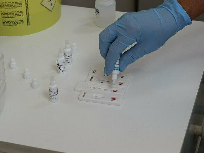 Нова възможност за безплатни тестове за ХИВ и хепатит